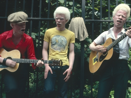 Albino musicians by Arlene Gottfried